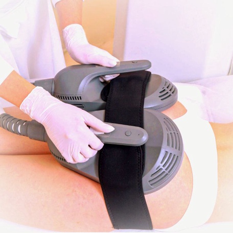 EMSCulpt